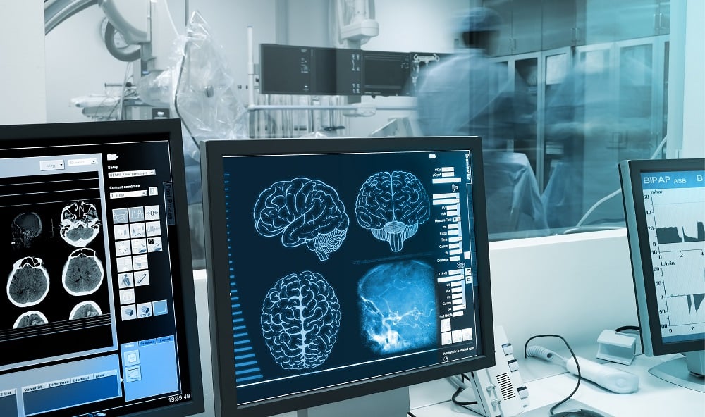 medical-device-equipment-brain-scan-imaging